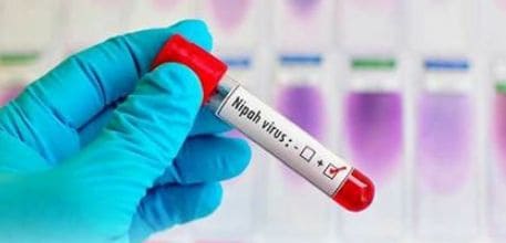 Nipah virus kerala 2019